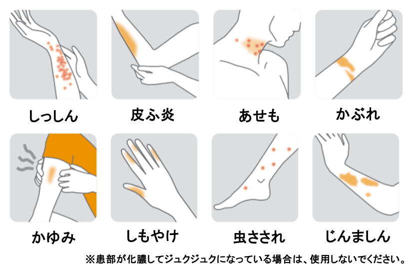 しっしん 皮ふ炎 あせも かぶれ かゆみ しもやけ 虫さされ じんましん などに効果があります