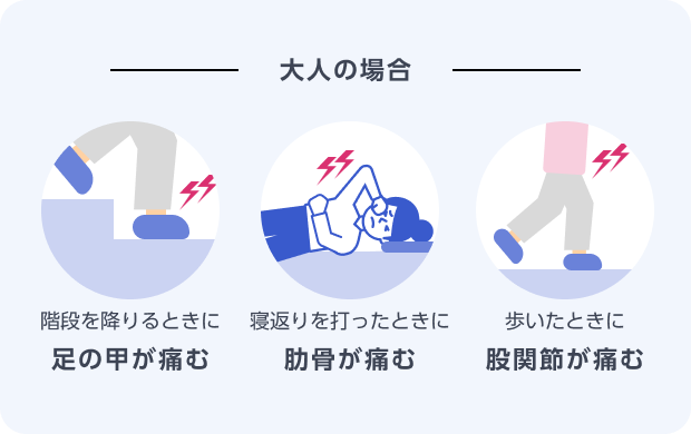 くる病の治療